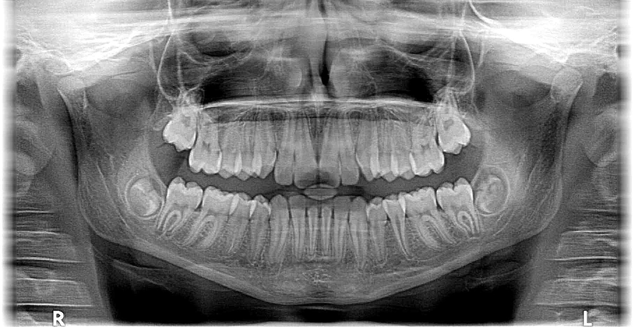 Współczesna ortodoncja – korony porcelanowe:  ortodonta Warszawa, cenni